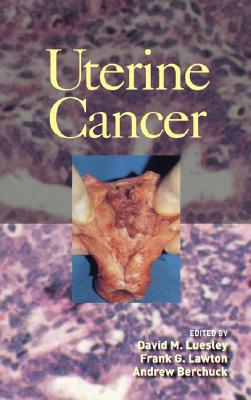 Uterine Cancer - Luesley, David M (Editor), and Lawton, Frank (Editor), and Berchuck, Andrew (Editor)