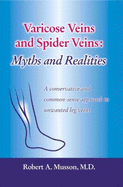 Varicose Veins and Spider Veins: Myths and Realities