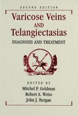 Varicose Veins and Telangiectasias: Diagnosis and Treatment, Second Edition - Goldman, Mitchel P (Editor), and Weiss, Robert A, M.D. (Editor), and Bergan, John J, M.D. (Editor)