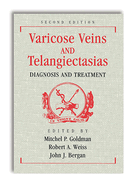 Varicose Veins and Telangiectasias: Diagnosis and Treatment, Second Edition