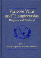 Varicose Veins and Telangiectasias - Bergan, John J, M.D.