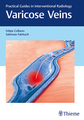 Varicose Veins: Practical Guides in Interventional Radiology - Collares, Felipe, and Faintuch, Salomao