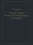 Verlauf Der Wichtigsten Knochen- Und Gelenkerkrankungen Im Rontgenbilde: Eine Anschauliche Prognostik