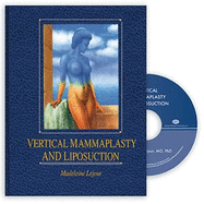 Vertical mammaplasty and liposuction