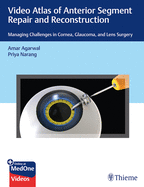 Video Atlas of Anterior Segment Repair and Reconstruction: Managing Challenges in Cornea, Glaucoma, and Lens Surgery