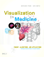 Visualization in Medicine: Theory, Algorithms, and Applications - Preim, Bernhard, and Bartz, Dirk