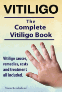 Vitiligo. Vitiligo Causes, Remedies, Costs and Treatment All Included. the Complete Vitiligo Book.