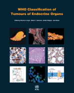 Who Classification of Tumours of Endocrine Organs [Op]