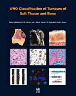 Who Classification of Tumours of Soft Tissue and Bone [op]