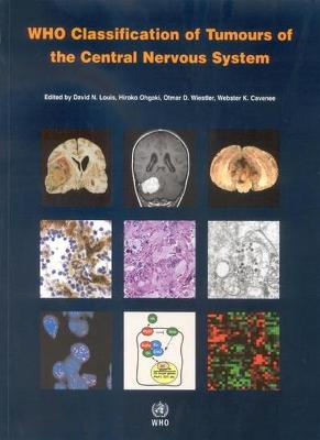 Who Classification of Tumours of the Central Nervous System Who Classification of Tumours of the Central Nervous System Who Classification of Tumours of the Central Nervous System - Louis, David N, and Cavenee, W K (Editor), and Ohgaki, H (Editor)