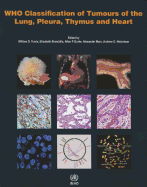 WHO classification of tumours of the lung, plura, thymus and heart
