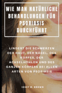 Wie Man Nat?rliche Behandlungen F?r Psoriasis Durchf?hrt: Lindert Die Schmerzen Der Haut, Der N?gel, Des Kopfes, Der Achselhhlen Und Des Ganzen Krpers Bei Allen Arten Von Psoriasis