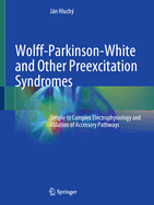 Wolff-Parkinson-White and Other Preexcitation Syndromes: Simple to Complex Electrophysiology and Ablation of Accessory Pathways