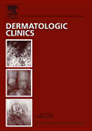 Women's Dermatology, an Issue of Dermatologic Clinics: Volume 24-2