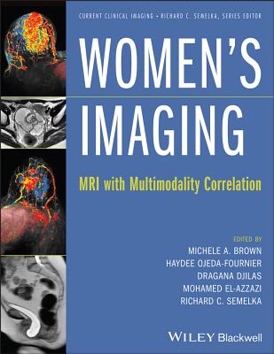 Women's Imaging: MRI with Multimodality Correlation - Brown, Michele A (Editor), and Ojeda-Fournier, Haydee, MD (Editor), and Djilas, Dragana (Editor)