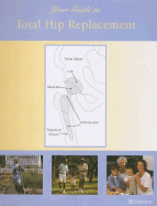 Your Guide to Total Hip Replacement