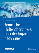 Zementfreie Hftendoprothese: Lateraler Zugang Nach Bauer